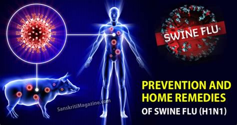 Prevention And Home Remedies Of Swine Flu H1n1 Sanskriti Hinduism
