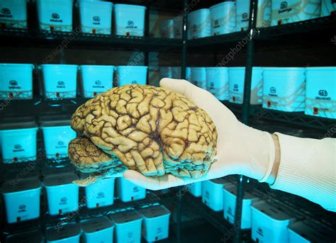 Human Brain In Brain Bank Stock Image M8760093 Science Photo Library