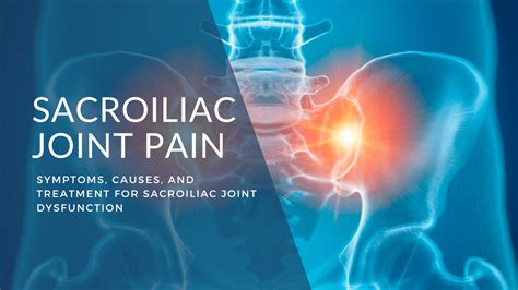 Sacroiliac Joint Pain Causes Symptoms Treatment 2022 The