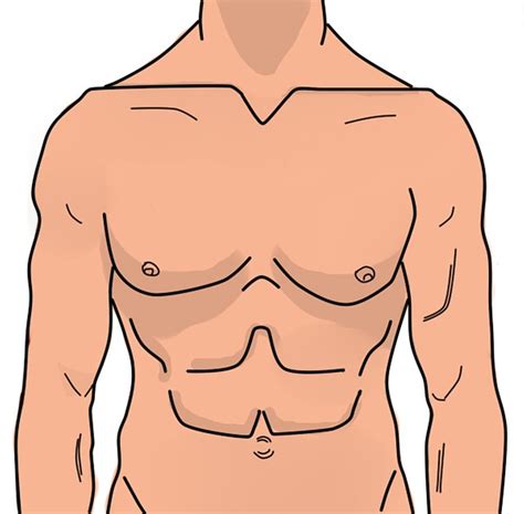 Diastasis Recti In Men Cause And Treatment Wound Care Society
