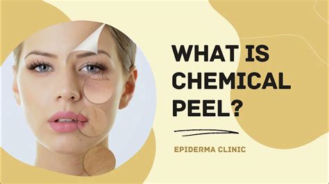 What Is Chemical Peel Best Dermatology Centres In Jayanagar