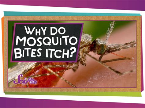 Why Do Mosquito Bites Itch Videos