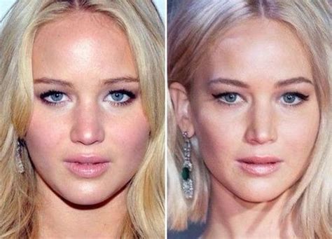 51 Most Popular Celebrity Nose Jobs Before And After With Images Fabbon