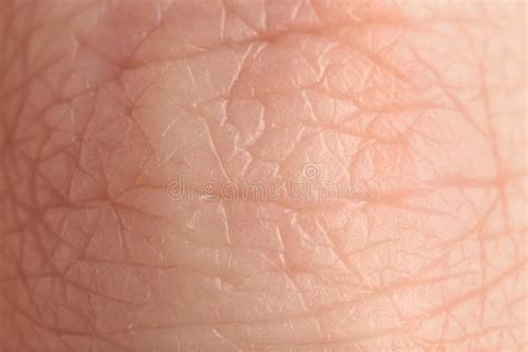 6982 Human Skin Texture Closeup Stock Photos Free And Royalty Free