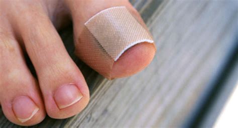 Hammer Toe Causes Of Hammer Toe
