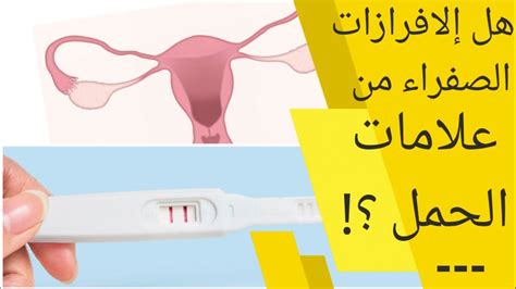 افرازات صفراء قبل الدورة من علامات الحمل