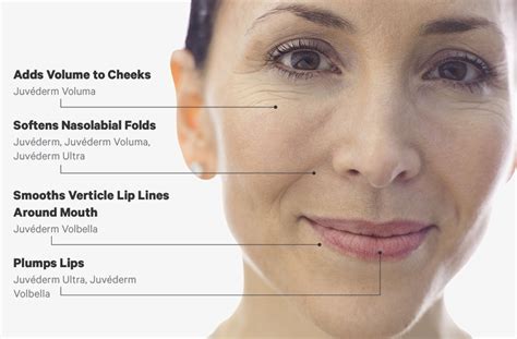 Our Juvederm Faqs What Is It And Is It Safe Dr Amy Vaughan