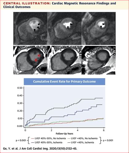 Prognostic Value Of Stress Cmr Perfusion Imaging In Patients With