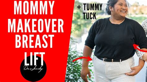 Mommy Makeoverbreast Lift And Tummy Tuck Mommy Makeover Must Haves
