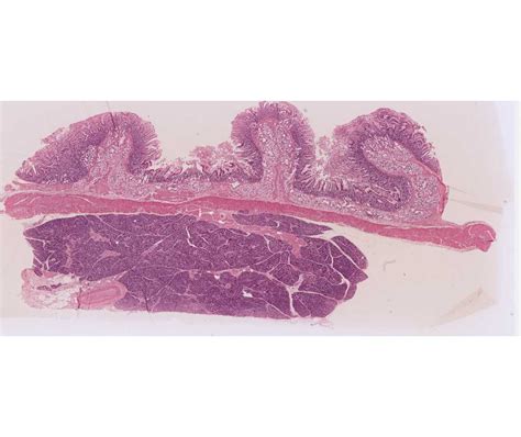 Colon Vs Small Intestine Histology Intestinal Preparation Techniques