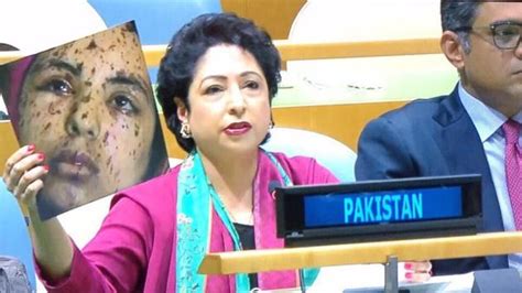 Pak Diplomat Goofs Up At UN Tries To Pass Off Gaza Teen Image As Kashmir Girl World News
