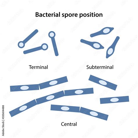 Fototapeta The Position Of The Bacillus Spores Central Terminal