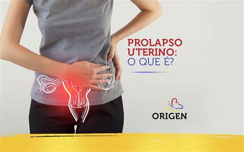 Prolapso uterino o que é Clínica Origen Fertilização in Vitro