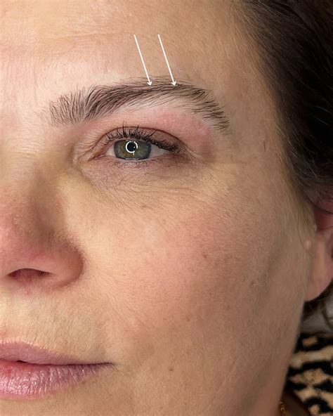 Thinning Eyebrows And Hairs This Might Be The Cause — Your Eyes