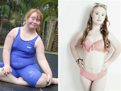 Down Syndrome Model Madeline Stuart Australia Welovebuzz