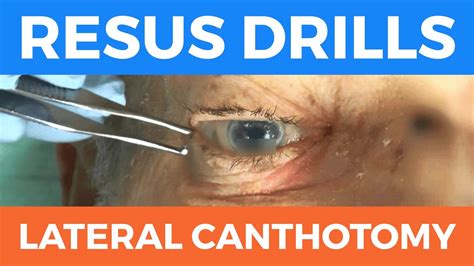 Resus Drills Lateral Canthotomy — Em3 East Midlands Emergency