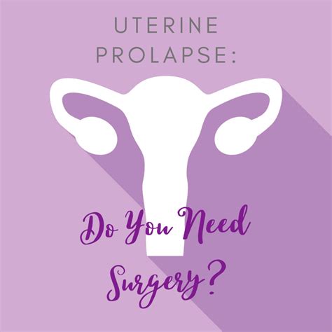 Uterine Prolapse Do You Need Surgery Sunshine State Women S Care Llc