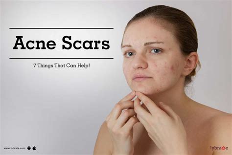 7 Best Home Remedies For Acne Scars On Face Try Out Now By Dr Pooja Devi Malipatil Lybrate