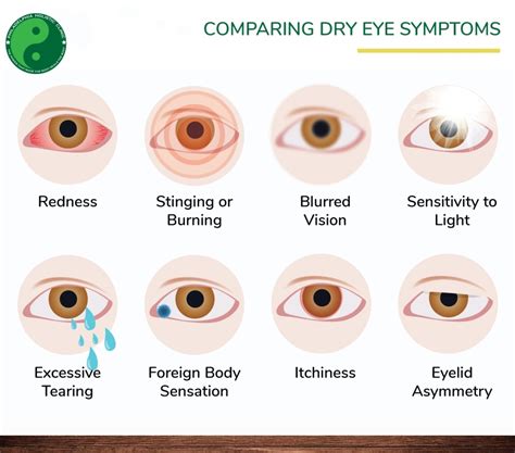 Treatment For Dry Eyes Philadelphia Holistic Clinic Dr Tsan And Assoc