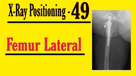 Femur Lateral Projection Hindi X Ray Positioning For Radiographers