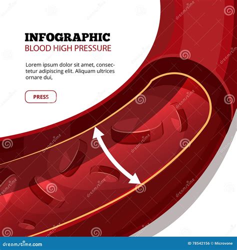 Blood High Pressure Vector Medical Infographic Stock Vector