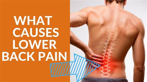 What You Should Know About Causes Of Lower Back Pain Youtube