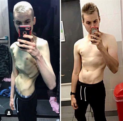 Homem Posta Foto Ap S Vencer Anorexia E Coment Rios S O Inacredit Veis V Rgula