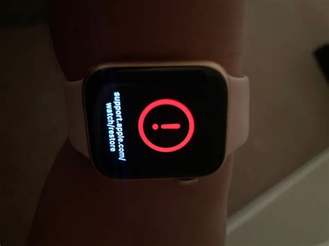 My Watch Has A Red Exclamation Mark Apple Community