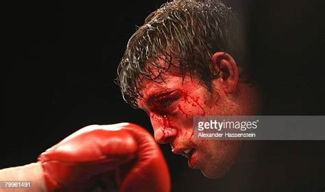 Alexander Ireland Boxer Photos And Premium High Res Pictures Getty Images