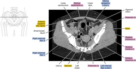 Abdominal Anatomy Chart Female Anatomy Of The Female Pelvis Ct Mri My