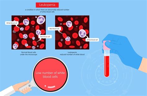Doctors can tell you have a low white blood cell count by doing a routine complete blood count (cbc). What Does Low White Blood Cell Count Mean? - Leukopenia