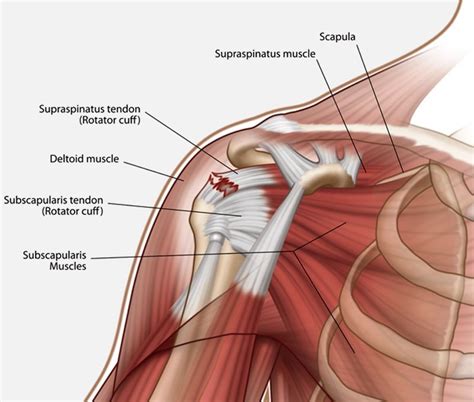 The shoulder anatomy includes the anterior deltoid, lateral deltoid, posterior deltoid, as well as the 4 rotator cuff muscles. ROTATOR CUFF TENDON INJURY, DIAGNOSIS, TREATMENT AND ...
