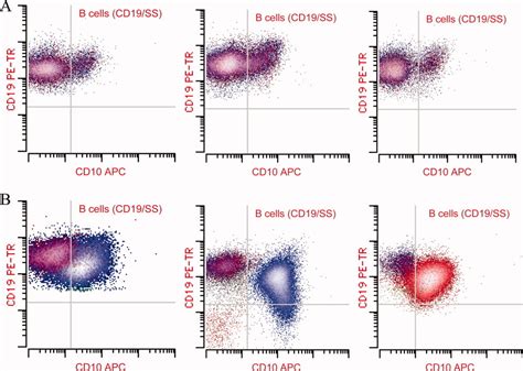 Flow Cytometric Evaluation Of Cd38 Expression Assists In Distinguishing