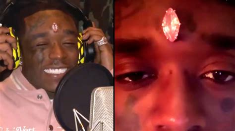 Lil Uzi Vert Diamond Implant Lil Uzi Vert Says Fans Ripped 24 Million
