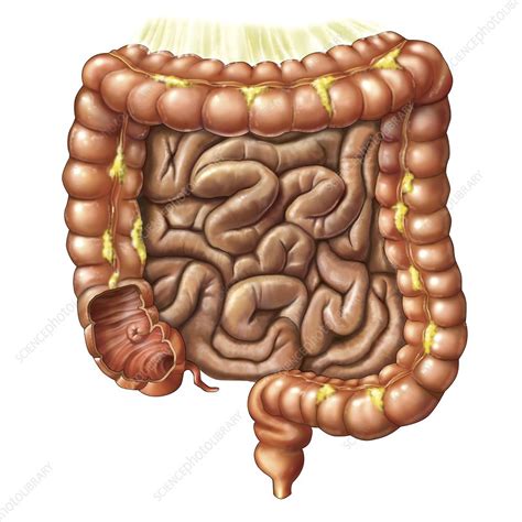 small intestine artwork stock image c021 2444 science photo library
