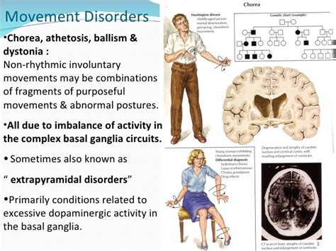 Movement Disorders Lecture Nursing Information Disorders