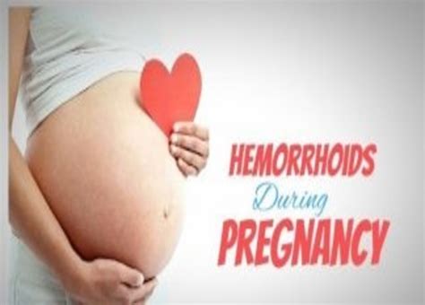 Moma Baby Etc Dealing With Hemorrhoids During Pregnancy