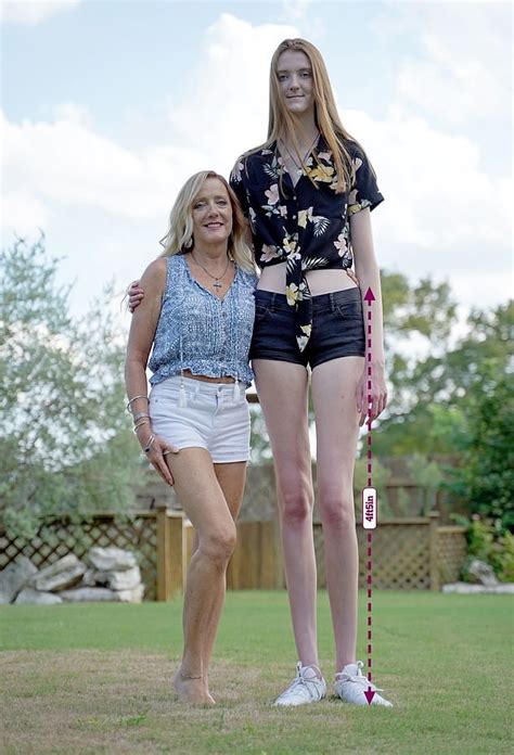 Meet The Year Old Woman Who Has The Longest Legs In The World Small Joys