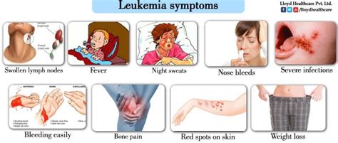 Skin Leukemia Symptoms In Children Symptoms Of Disease
