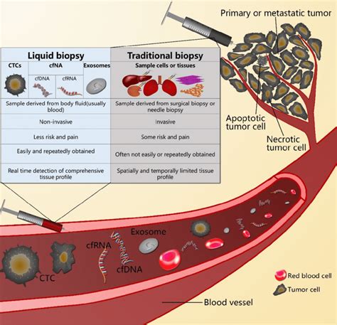 The Difference Between Liquid Biopsy And Traditional Biopsy Download