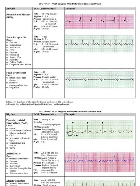 Pin By Vicky K On Cardiac Nursing Ekg Interpretation Cheat Sheets