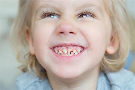 305 Child Rotten Teeth Stock Photos Free And Royalty Free Stock Photos