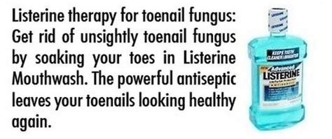 Listerine For Toenail Fungus Toenail Fungus Toe Nails Nail Fungus