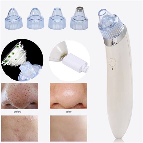 Electric Blackhead Remover Device Vacuum Extraction Usb Rechargeable