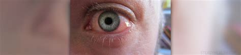 Sore Eyes Causes Eye Disorders And Diseases Articles Body And Health
