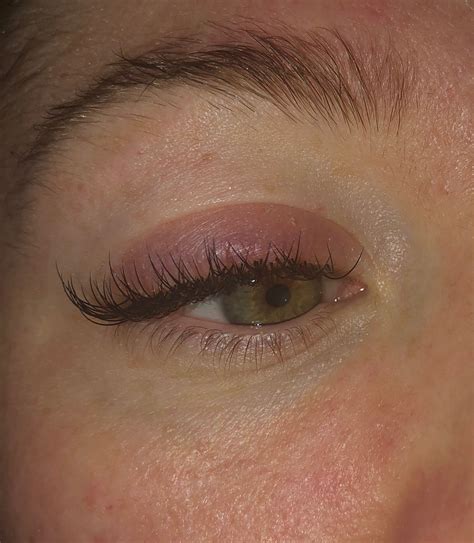 Allergic Reactions To Eyelash Extensions Whip Lash