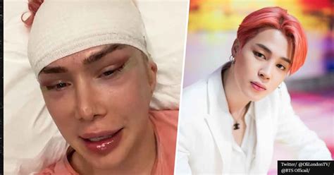 Influencer Who Identifies As Korean After 18 Surgeries To Look Like Bts