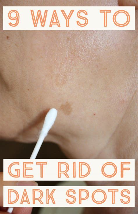 How To Get Rid Of Dark Spots On Your Face With 9 Easy Tips Spots On