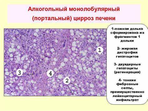 БОЛЕЗНИ ПЕЧЕНИ Лекция Проф Л В Волкова 2013 Картинка - БОЛЕЗНИ ПЕЧЕНИ Лекция Проф Л В Волкова 2013