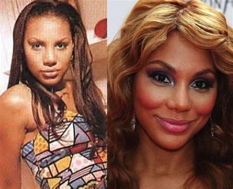 Celebrity Before And After Plastic Surgery Tamar Braxton Plastic
